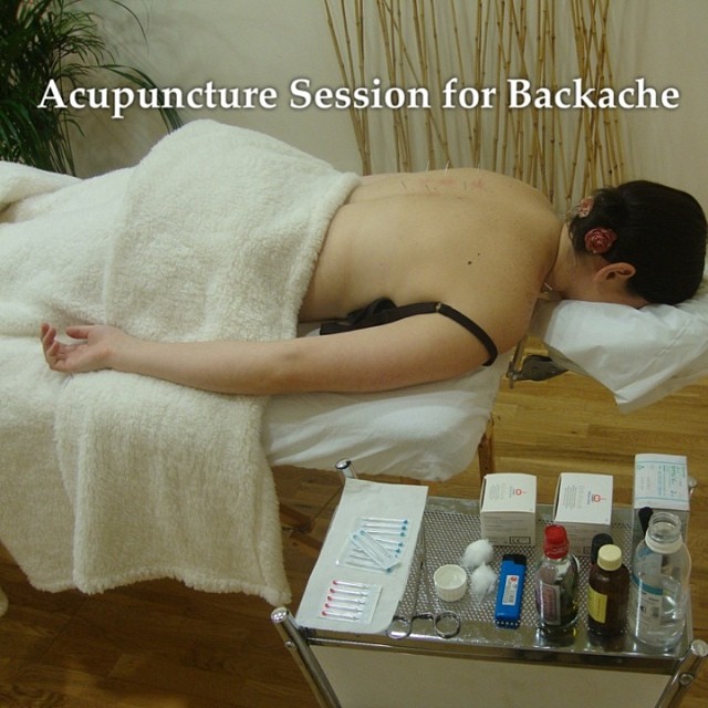 Acupuncture for back pain at Well-Being-Dublin
